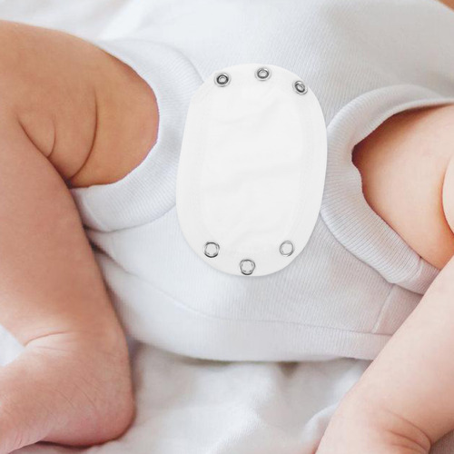 Monos Extensores De Una Sola Capa Para Bebés
