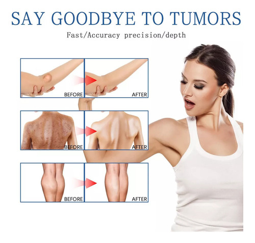 2× Crema Eliminación Lipomas Q Lipoma Crema Limpiadora
