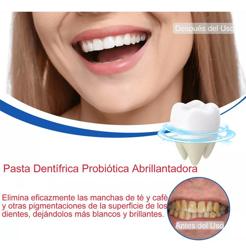 Paquete De 3 Pastas Dentales Blanqueadoras Probióticas Sp6 1