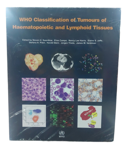 Who Classification Of Tumours Of Haematopoietic And Lymphoid