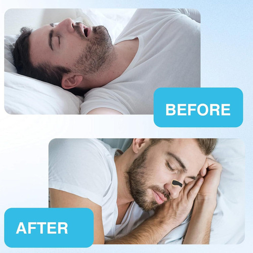 Hh Pack Of 15intake Breathing Nasal Strip, Anti Snoring