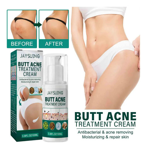 2 Creme Reparador Acne B Hidratante Para Eliminar A Acne.
