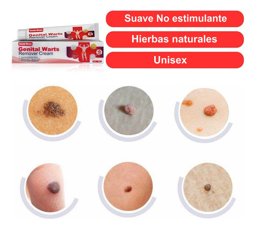5 Piezas Ungüento Removedor Verrugas Del Herpes Genital