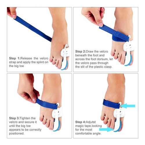Aparato Para Juanetes Corrector Protector Para Dedos De Pies