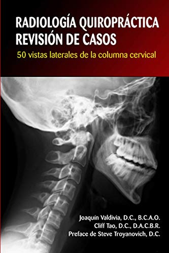 Radiologia Quiropráctica: Revisión De Casos. 50 Vistas Más T