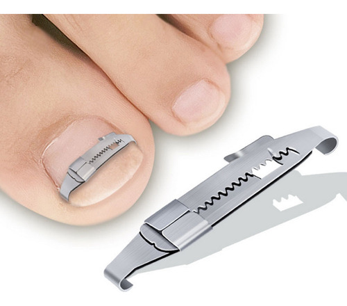 Kit De Herramientas Para Uñas Encarnadas Tratamiento De Uñas