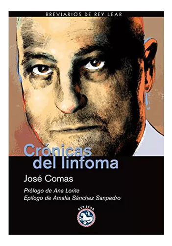 Cronicas Del Linfoma Seguido De Cartas - Comas Jose - #w