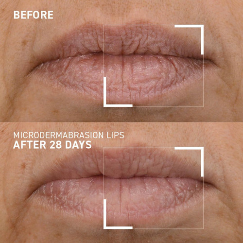 Exfoliante Labial Dr. Brandt Microdermabrasion Suavizante 10