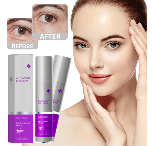 Crema Hidratante Para Ojos W Eye Cream Anting Wrinkle 30 Ml