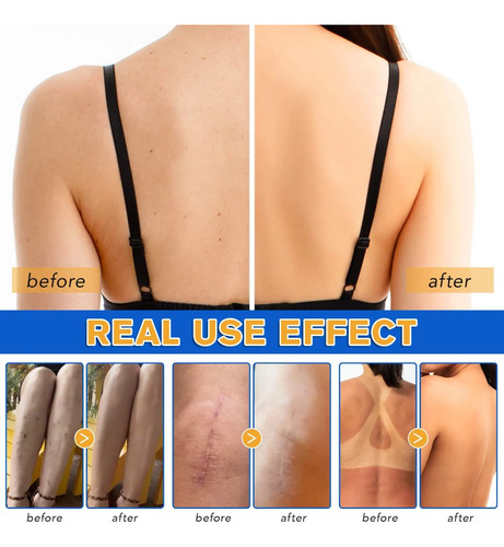 Loción Maquillaje Piernas Manchas Cicatrices Resistente Agua Brillo Medio