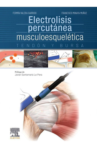 Libro: Electrolisis Percutánea Musculoesquelética. Tendón Y 