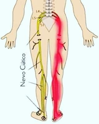 Cinta Fisioterapia Magnética Domiciliar