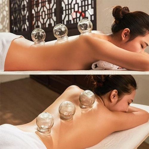 Kit Ventosa De Vidro Terapia Com 14 Peças Completo
