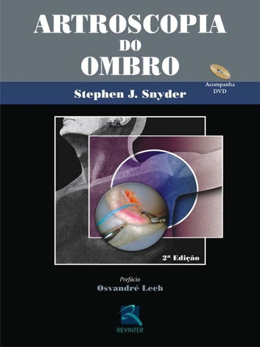 Artroscopia Do Ombro, De Null. Editora Revinter, Capa Dura Em Português, 5