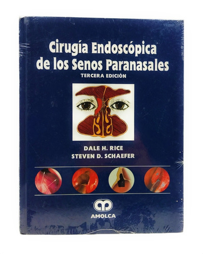 Imagen 1 de 3 de Libro Cirugia Endoscopica Senos Paranasales Amolca 3ª Ed