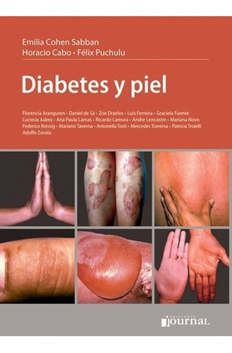 Cohen - Diabetes Y Piel 1 Ed. Envíos A T/país