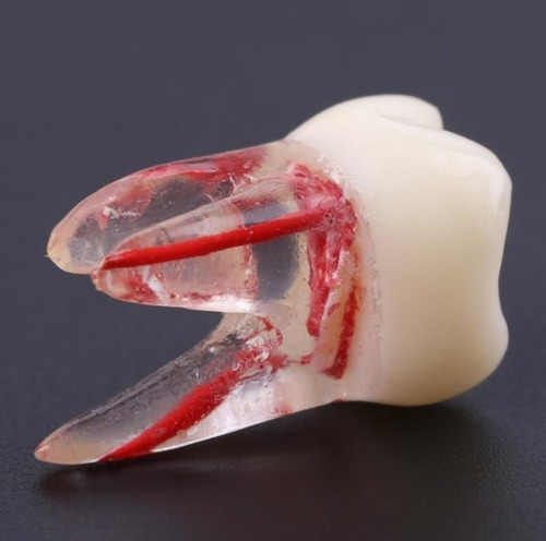 Imagen 3 de 10 de Molar Para Práctica Endodoncia Enseñanza Santiago