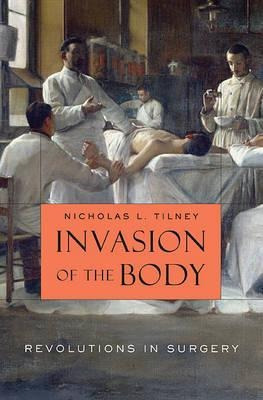 Invasion Of The Body : Revolutions In Surgery - N (hardback)