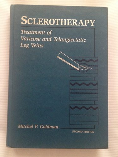 Sclerotherapy. Mitchel P. Goldman