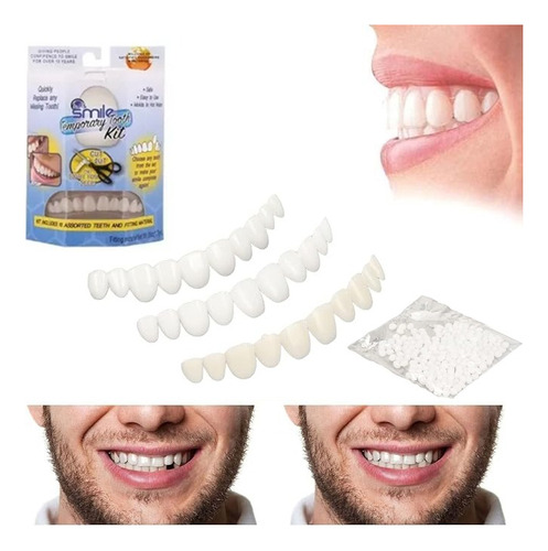 Kit De Dientes Temporales Reparacion Dental Dientes Postizos