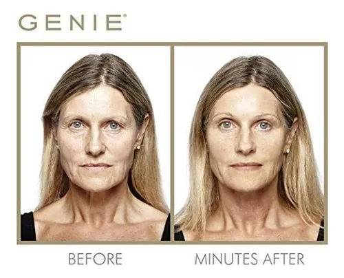 Genie Instant Line Smoother, 19 Ml/.63 F