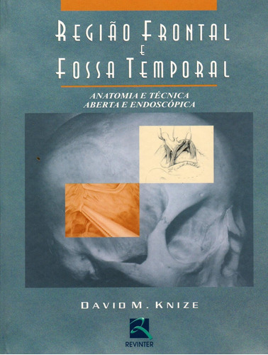 Livro Região Frontal E Fossa Temporal