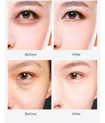 Tarro Parches Hydrogel Ojos Colágeno Antiojeras Hidratante F Tipo De Piel Mod 2 Acido Hialuronico