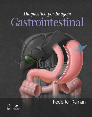 Diagnóstico por Imagem: Gastrointestinal, de Michael P Federle. Editora Gen – Grupo Editorial Nacional Part S/A, capa mole em português, 2017