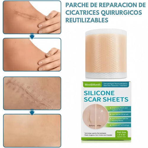 4cm*1.5 Metros Parche Silicón Reutilizable Cicatrices Rollo