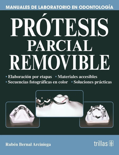 Prótesis Parcial Removible Manuales De Laboratorio Trillas