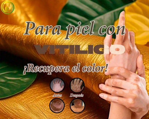 Cenit, Kit Tópico Para Piel Con Vitíligo