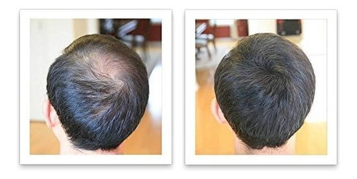 Corrector De Pérdida De Cabello Caboki - Marrón Oscuro