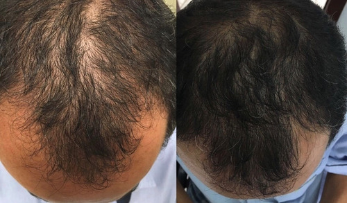 Imagem 8 de 8 de Remédio Cresce Cabelo Biotina Aumento Brilho Dos Fios Unisex