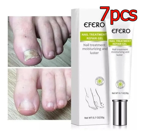 La Crema En Gel Reparadora De Uñas Efero De 7 Piezas Mejora