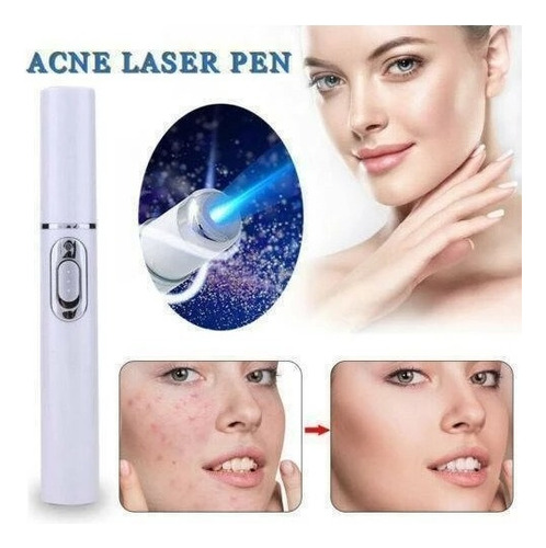 Caneta Laser Wrinkle Acne Para Varizes