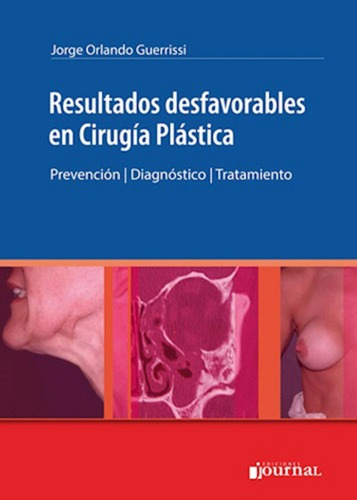 Resultados Desfavorables En Cirugia Plastica. Prevención. Di