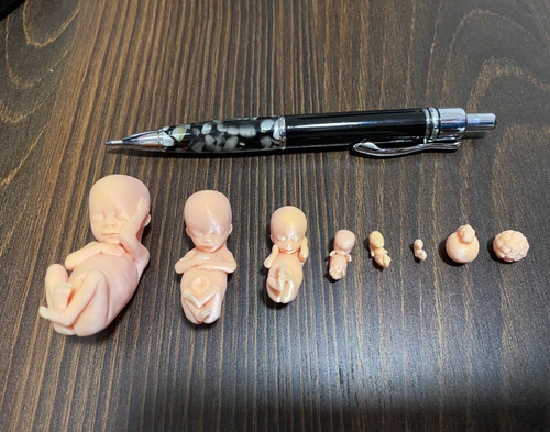 Feto Anatomia De 4 A 12 E 16 Resina E 22 Semanas Com Base
