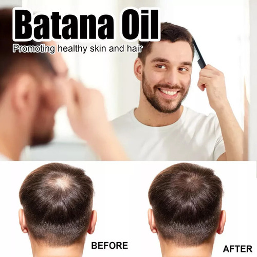 Aceite De Batana De 60ml*3 Para El Crecimiento Del Cabello.