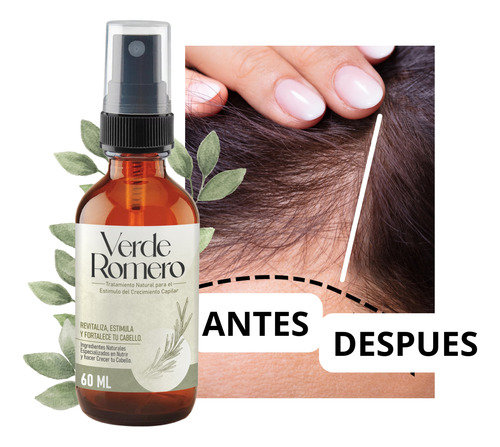 Concentrado De Romero Crecimiento De Cabello Anticaída 60ml