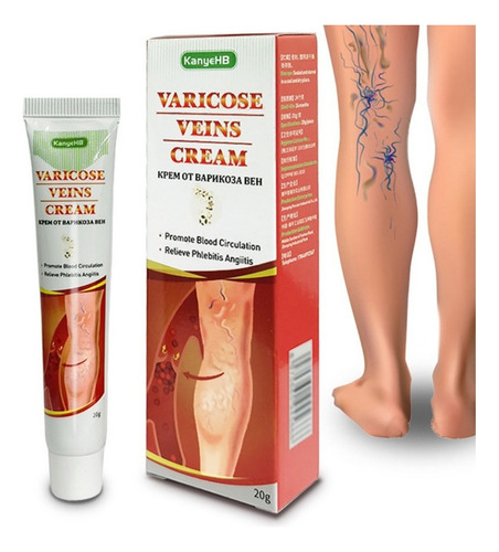 Crema para Venas Varicosas Trata Varices Hinchazón Dolores en las Piernas Fragancia Suave Tipo de Embalaje Tubo