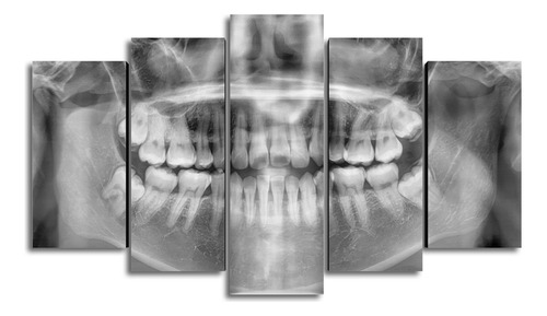 Cuadros Decorativos Odontólogo Sonrisa Dentista Ortodoncia