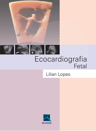 Ecocardiografia Fetal, de Lopes, Lilian. Editora Thieme Revinter Publicações Ltda, capa dura em português, 2015