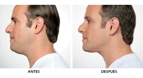Tensor Anti Papada Unica Crema Reductora Hombre Mujer Pack 4