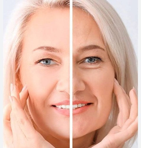 Serum Facial Vitamina C Antimanchas Hidrata Hialuronico 30ml