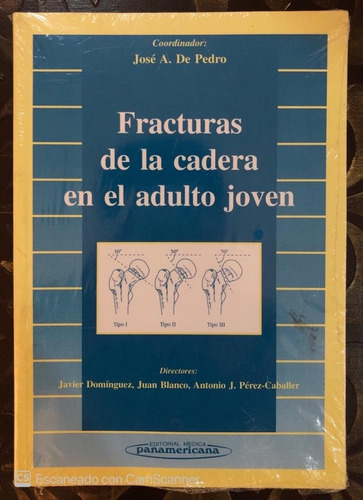 Libro Fracturas De La Cadera En El Adulto Joven