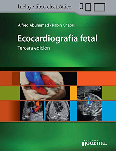 Libro Ecocardiografía Fetal De Alfred Z Abuhamad Rabih Chaou