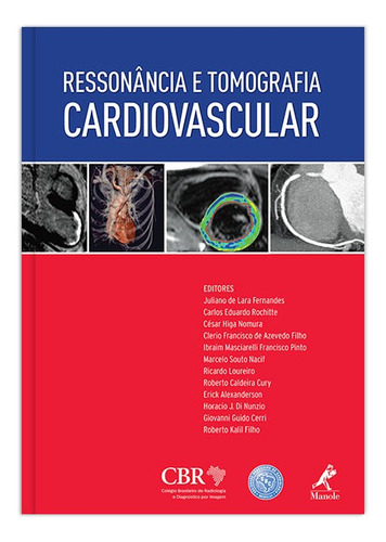 Ressonância e tomografia cardiovascular, de Heuck, Andreas. Editorial Editora Manole Saúde, capa mole em português, 2013