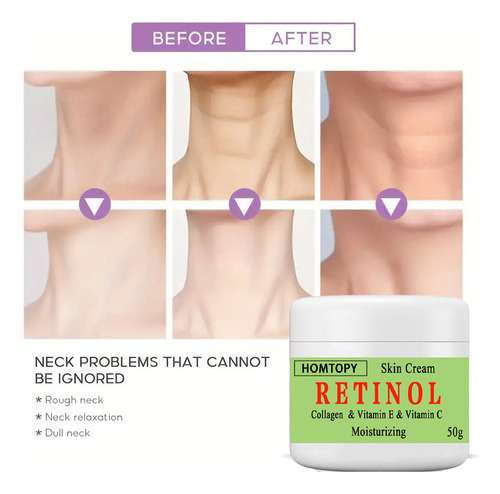 P Skin Beautifying Ilumina E Rejuvenesce A Pele Beaut 1014