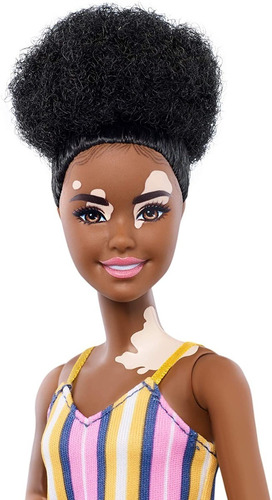 Muñeca Barbie Fashionistas Vitiligo Y Pelo Rizado Morena