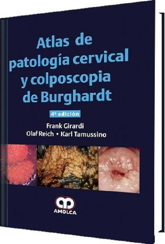 Libro - Atlas De Patología Cervical Y Colposcopia De Burgha